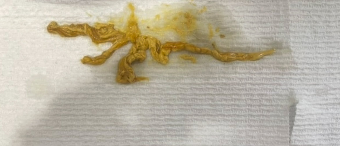 Parasites Out